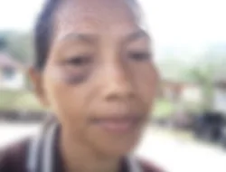 Dugaan KDRT di Cibal Manggarai: Istri Alami Luka Serius dan Gangguan Pendengaran, Kasus Dilaporkan ke Polisi