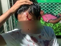 Kekerasan dan Pengeroyokan Anak dibawah Umur di Belitang: 3 Pelaku Dewasa Teridentifikasi, Proses Hukum Tetap Berjalan Meski Ada Upaya Perdamaian